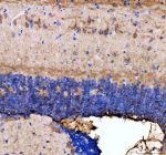 IHC staining of FFPE zebrafish brain tissue with Zebrafish Dnm1 antibody, HRP-labeled secondary and DAB substrate. HIER: boil tissue sections in pH8 EDTA for 20 min and allow to cool before testing.