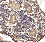 IHC staining of FFPE zebrafish kidney tissue with Hbae1.1 antibody, HRP-labeled secondary and DAB substrate. HIER: boil tissue sections in pH8 EDTA for 20 min and allow to cool before testing.