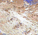 IHC staining of zebrafish Insulin like growth factor 1 protein using Zebrafish Insulin like growth factor 1 antibody, HRP-labeled secondary and DAB substrate. Insulin like growth factor 1 was detected in a paraffin-embedded section of zebrafish brain tissue. HIER: boil tissue sections in pH8 EDTA for 20 min and allow to cool before testing.