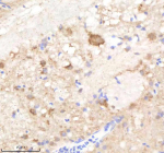 IHC staining of FFPE zebrafish brain tissue with Pik3cb antibody, HRP-labeled secondary and DAB substrate. HIER: boil tissue sections in pH8 EDTA for 20 min and allow to cool before testing.