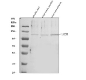 Western blot analysis of Leo1 protein using Zebrafish Leo1 antibody and 1) zebrafish head, 2) whole female zebrafish and 3) whole male zebrafish tissue lysate. Predicted molecular weight ~76 kDa but can be observed at ~105 kDa (human similarity).