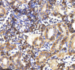 IHC staining of FFPE zebrafish kidney tissue with Zebrafish Lysozyme antibody, HRP-labeled secondary and DAB substrate. HIER: boil tissue sections in pH8 EDTA for 20 min and allow to cool before testing.