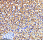 IHC staining of FFPE zebrafish liver tissue with Zebrafish Lysozyme antibody, HRP-labeled secondary and DAB substrate. HIER: boil tissue sections in pH8 EDTA for 20 min and allow to cool before testing.