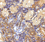 IHC staining of zebrafish Mpeg1 protein using Zebrafish Mpeg1 antibody, HRP-labeled secondary and DAB substrate. Mpeg1 was detected in a paraffin-embedded section of zebrafish kidney tissue. HIER: boil tissue sections in pH8 EDTA for 20 min and allow to cool before testing.