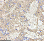 IHC staining of zebrafish Npepps protein using Zebrafish Npepps antibody, HRP-labeled secondary and DAB substrate. Npepps was detected in a paraffin-embedded section of zebrafish brain tissue. HIER: boil tissue sections in pH8 EDTA for 20 min and allow to cool before testing.