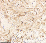 IHC staining of zebrafish Pa2g4 protein using Zebrafish Pa2g4 antibody, HRP-labeled secondary and DAB substrate. Pa2g4 was detected in a paraffin-embedded section of zebrafish heart tissue. HIER: boil tissue sections in pH8 EDTA for 20 min and allow to cool before testing.