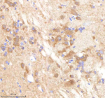 IHC staining of FFPE zebrafish brain tissue with Pafah1b1 antibody, HRP-labeled secondary and DAB substrate. HIER: boil tissue sections in pH8 EDTA for 20 min and allow to cool before testing.
