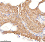 IHC staining of FFPE zebrafish pancreas tissue with Pafah1b1 antibody, HRP-labeled secondary and DAB substrate. HIER: boil tissue sections in pH8 EDTA for 20 min and allow to cool before testing.