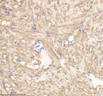 IHC staining of zebrafish Pgam1a/b protein using Zebrafish Pgam1 antibody, HRP-labeled secondary and DAB substrate. Pgam1 was detected in a paraffin-embedded section of zebrafish heart tissue. HIER: boil tissue sections in pH8 EDTA for 20 min and allow to cool before testing.