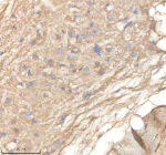IHC staining of zebrafish Ppm1g protein using Zebrafish Ppm1g antibody, HRP-labeled secondary and DAB substrate. Ppm1g was detected in a paraffin-embedded section of zebrafish brain tissue. HIER: boil tissue sections in pH8 EDTA for 20 min and allow to cool before testing.