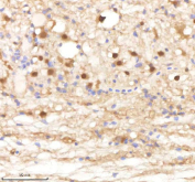 IHC staining of FFPE zebrafish spinal tissue with Psma1 antibody, HRP-labeled secondary and DAB substrate. HIER: boil tissue sections in pH8 EDTA for 20 min and allow to cool before testing.