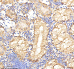 IHC staining of FFPE zebrafish kidney tissue with Psma5 antibody, HRP-labeled secondary and DAB substrate. HIER: boil tissue sections in pH8 EDTA for 20 min and allow to cool before testing.