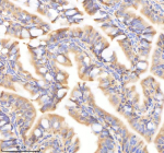 IHC staining of FFPE zebrafish colon tissue with Psmc2 antibody, HRP-labeled secondary and DAB substrate. HIER: boil tissue sections in pH8 EDTA for 20 min and allow to cool before testing.