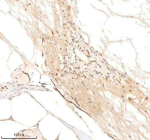 IHC staining of zebrafish Psmc5 protein using Zebrafish Psmc5 antibody, HRP-labeled secondary and DAB substrate. Psmc5 was detected in a paraffin-embedded section of zebrafish spinal tissue. HIER: boil tissue sections in pH8 EDTA for 20 min and allow to cool before testing.