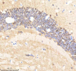IHC staining of zebrafish Psmc5 protein using Zebrafish Psmc5 antibody, HRP-labeled secondary and DAB substrate. Psmc5 was detected in a paraffin-embedded section of zebrafish brain tissue. HIER: boil tissue sections in pH8 EDTA for 20 min and allow to cool before testing.