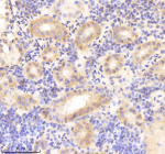 IHC staining of FFPE zebrafish kidney tissue with Rcc2 antibody, HRP-labeled secondary and DAB substrate. HIER: boil tissue sections in pH8 EDTA for 20 min and allow to cool before testing.