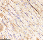 IHC staining of FFPE zebrafish muscle tissue with Rcc2 antibody, HRP-labeled secondary and DAB substrate. HIER: boil tissue sections in pH8 EDTA for 20 min and allow to cool before testing.