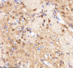 IHC staining of zebrafish Sf3b3 protein using Zebrafish Sf3b3 antibody, HRP-labeled secondary and DAB substrate. Sf3b3 was detected in a paraffin-embedded section of zebrafish brain tissue. HIER: boil tissue sections in pH8 EDTA for 20 min and allow to cool before testing.