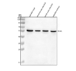 Western blot analysis of Shha protein using Zebrafish Shha antibody and 1) zebrafish head, 2) whole female zebrafish, 3) whole male zebrafish and 4) zebrafish embryo tissue lysate. Predicted molecular weight ~46 kDa.