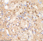 IHC staining of zebrafish Smarca4a protein using Zebrafish Smarca4a antibody, HRP-labeled secondary and DAB substrate. Smarca4a was detected in a paraffin-embedded section of zebrafish brain tissue. HIER: boil tissue sections in pH8 EDTA for 20 min and allow to cool before testing.