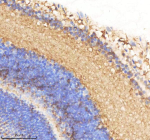 IHC staining of zebrafish Smarca4a protein using Zebrafish Smarca4a antibody, HRP-labeled secondary and DAB substrate. Smarca4a was detected in a paraffin-embedded section of zebrafish eye tissue. HIER: boil tissue sections in pH8 EDTA for 20 min and allow to cool before testing.