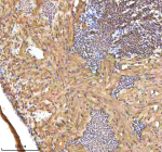 IHC staining of zebrafish Srebf1 protein using Zebrafish Srebf1 antibody, HRP-labeled secondary and DAB substrate. Srebf1 was detected in a paraffin-embedded section of zebrafish heart tissue. HIER: boil tissue sections in pH8 EDTA for 20 min and allow to cool before testing.