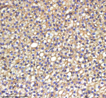 IHC staining of zebrafish Srebf1 protein using Zebrafish Srebf1 antibody, HRP-labeled secondary and DAB substrate. Srebf1 was detected in a paraffin-embedded section of zebrafish liver tissue. HIER: boil tissue sections in pH8 EDTA for 20 min and allow to cool before testing.
