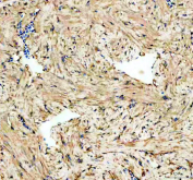 IHC staining of FFPE zebrafish heart tissue with Psmc3 antibody, HRP-labeled secondary and DAB substrate. HIER: boil tissue sections in pH8 EDTA for 20 min and allow to cool before testing.
