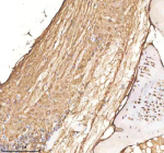IHC staining of FFPE zebrafish spinal cord tissue with Cdc48 antibody, HRP-labeled secondary and DAB substrate. HIER: boil tissue sections in pH8 EDTA for 20 min and allow to cool before testing.