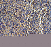 IHC staining of FFPE zebrafish liver tissue with Abcc12 antibody, HRP-labeled secondary and DAB substrate. HIER: boil tissue sections in pH8 EDTA for 20 min and allow to cool before testing.