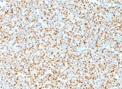 Cyclin D1 antibody immunohistochemistry