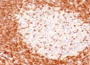 Bcl-2 antibody immunohistochemistry