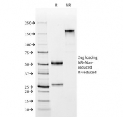 SDS-PAGE analysis of purified, BSA-free CD2 antibody (clone BH1) as confirmation of integrity and purity.