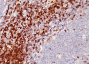 CD5 antibody immunohistochemistry