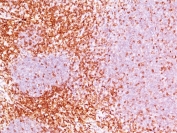 IHC staining of FFPE human tonsil tissue with CD6 antibody (clone 3F7B5). HIER: boil tissue sections in pH 9 10mM Tris with 1mM EDTA for 20 min and allow to cool before testing.