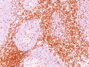 IHC staining of FFPE human tonsil tissue with CD6 antibody (clone 3F7B5). HIER: boil tissue sections in pH 9 10mM Tris with 1mM EDTA for 20 min and allow to cool before testing.