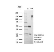 SDS-PAGE analysis of purified, BSA-free CD6 antibody (clone 3F7B5) as confirmation of integrity and purity.