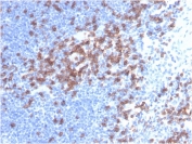 IHC staining of FFPE human lymph node tissue with CD8a antibody (clone C8/468). HIER: boil tissue sections in pH 9 10mM Tris with 1mM EDTA for 20 min and allow to cool before testing.