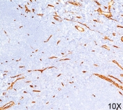 CD34 antibody QBEnd/10 immunohistochemistry 10X