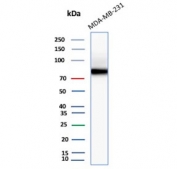 Western blot testing of MDA-MB-231 cell lysate with HCAM antibody (clone 156-3C11). Predicted molecular weight ~81 kDa.
