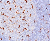 CD68 antibody KP1 + C68/684 immunohistochemistry tonsil