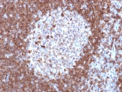 IHC testing of FFPE human tonsil stained with CD79a antibody (clone JCB117). Required HIER: boil tissue sections in pH 9 10mM Tris with 1mM EDTA for 10-20 min followed by cooling at RT for 20 minutes.