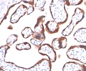 hCG alpha antibody HCGa/53 immunohistochemistry