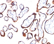 HCG-beta antibody HCGb/54 immunohistochemistry