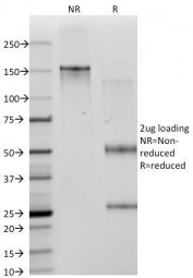 SDS-PAGE Analysis of Purified, BSA-Free CD35 Antibody (clone E11). Confirmation of Integrity and Purity of the Antibody.