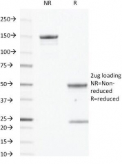 SDS-PAGE analysis of purified, BSA-free EGFR antibody (clone GFR450) as confirmation of integrity and purity.