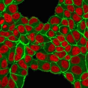 Immunofluorescent staining of PFA-fixed human MCF-7 cells with HER2 antibody (green) and Reddot nuclear stain (red).