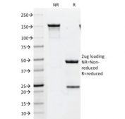 SDS-PAGE analysis of purified, BSA-free HER2 antibody (clone HRB2/451) as confirmation of integrity and purity.
