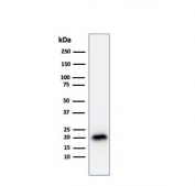 Western blot testing of human COLO-38 cell lysate with recombinant Melan-A antibody (clone A103). Expected molecular weight ~20 kDa with possible doublet.