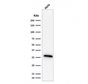 Western blot testing of human HeLa cell lysate with HSP27 antibody (clone G3.1). Expected molecular weight: 24-29 kDa.